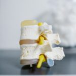 Calcium deficiency affects bone health how to make it right?